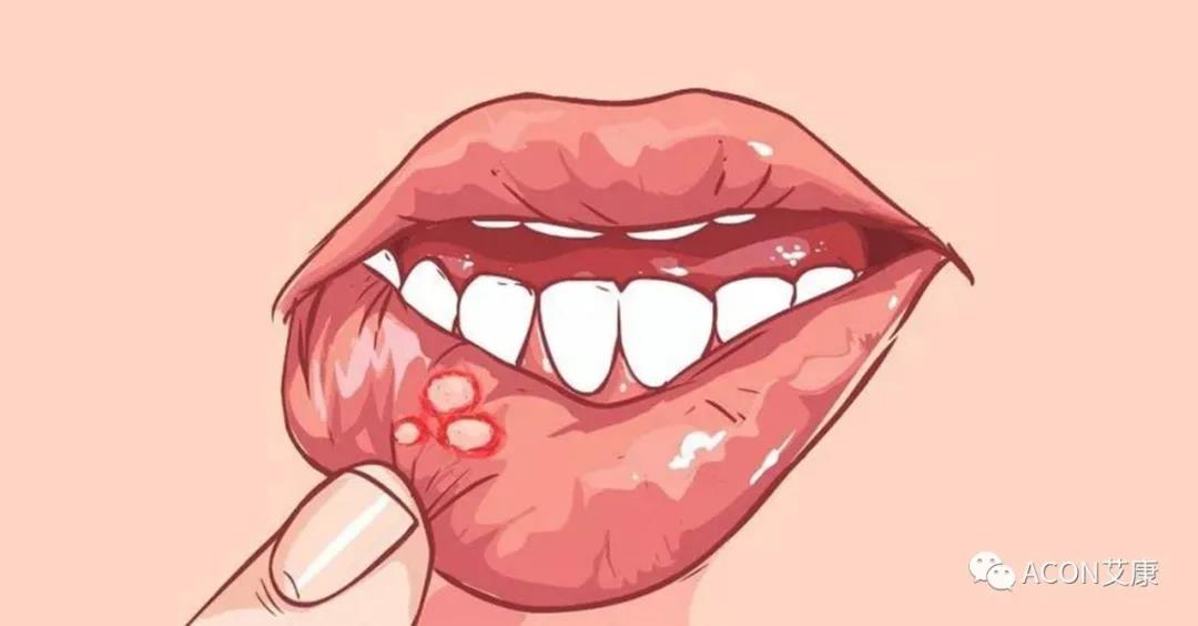 哪些小病容易讓人忽視，最后造成越拖越嚴(yán)重呢？