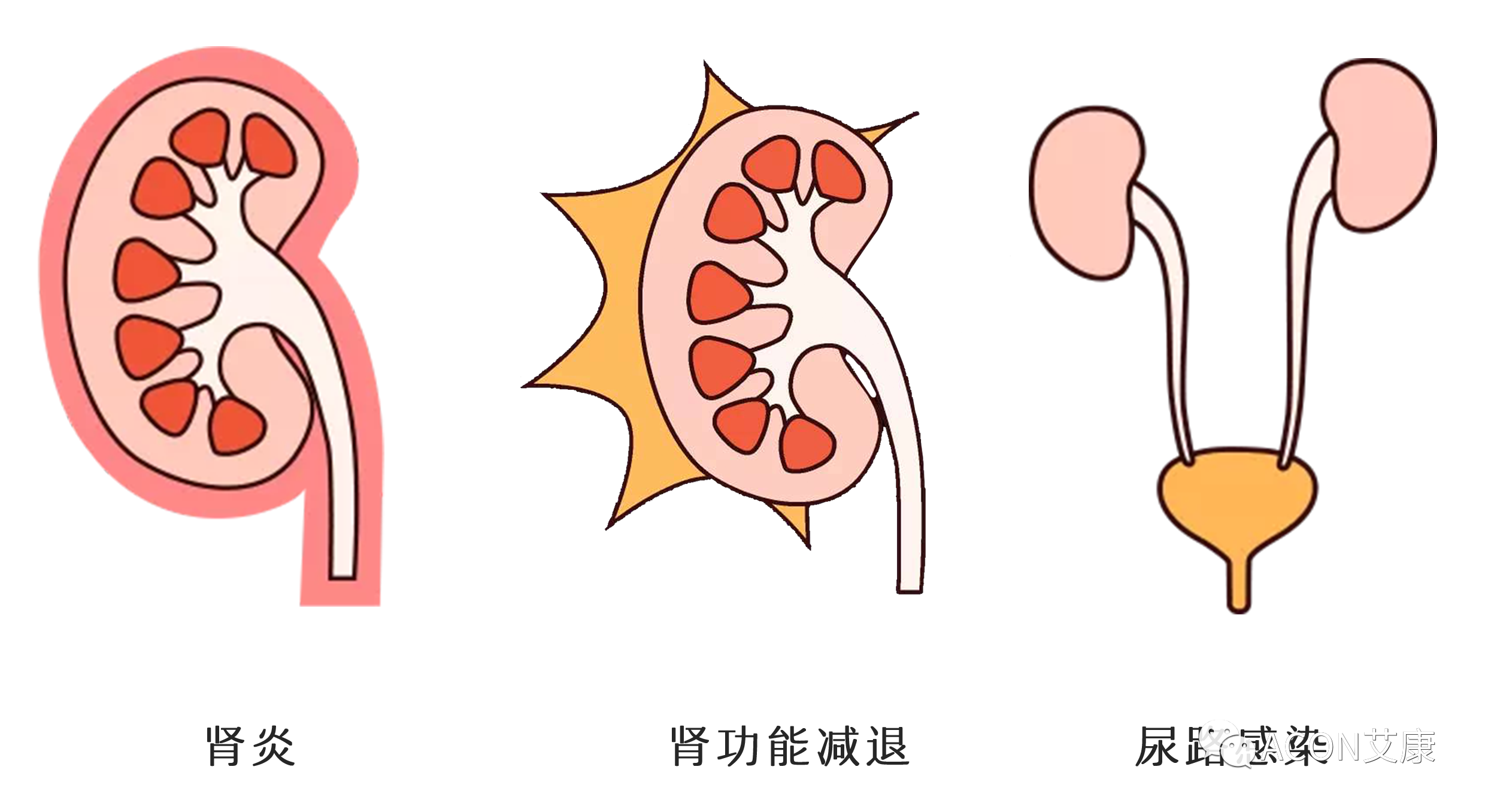 排尿黃、異味大，可能是身體在報警！