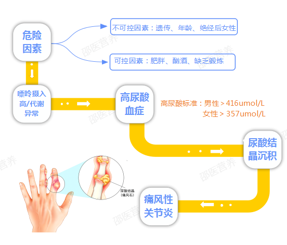 痛風(fēng)為什么偏愛男性？你最關(guān)心的問題都在這里