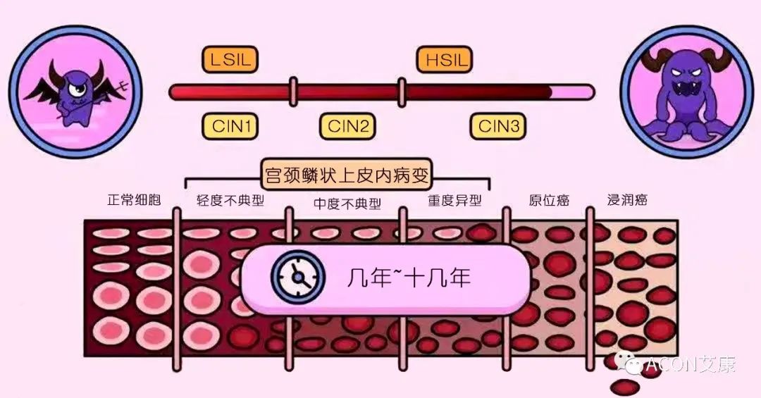 全球首次承諾消除一種癌癥，預(yù)計(jì)到2050年將挽救500萬(wàn)人的生命