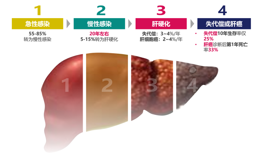 悄悄變成肝硬化、肝癌，很多人感染了卻不知道