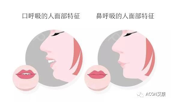 過敏性鼻炎會讓孩子變傻？！家長該如何應(yīng)對